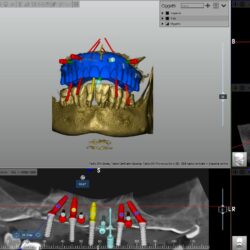 Screenshot 2025-03-06 173846